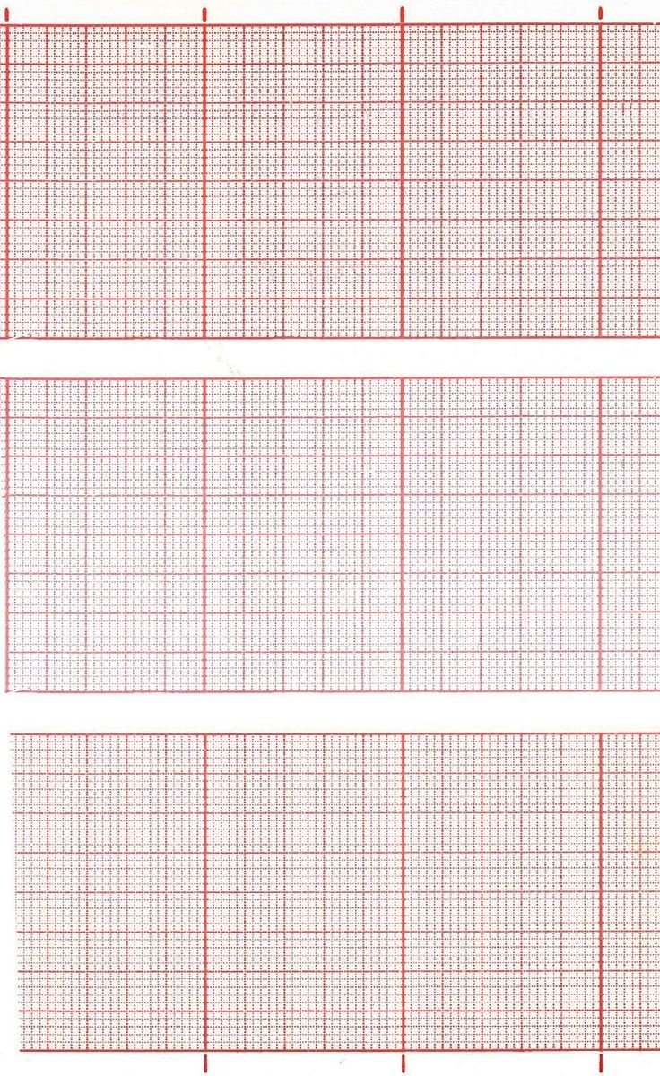 ecg paper roll fukuda / 145mm x 30m