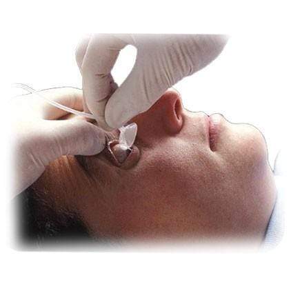 Morgan Lens Ocular Irrigation