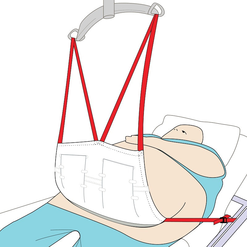 Pannus Apron Sling