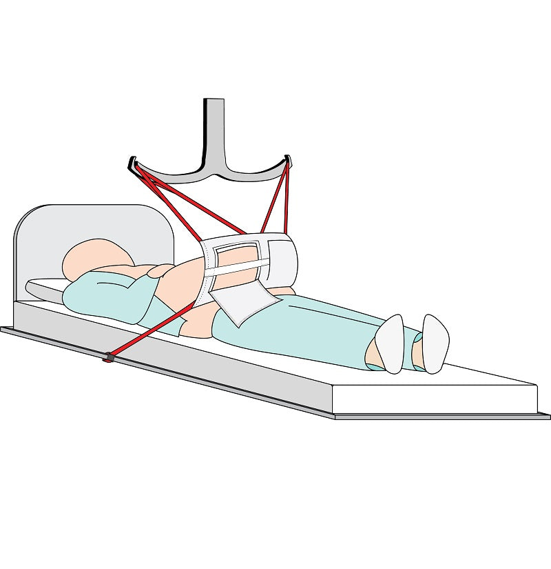 Pannus Apron Sling