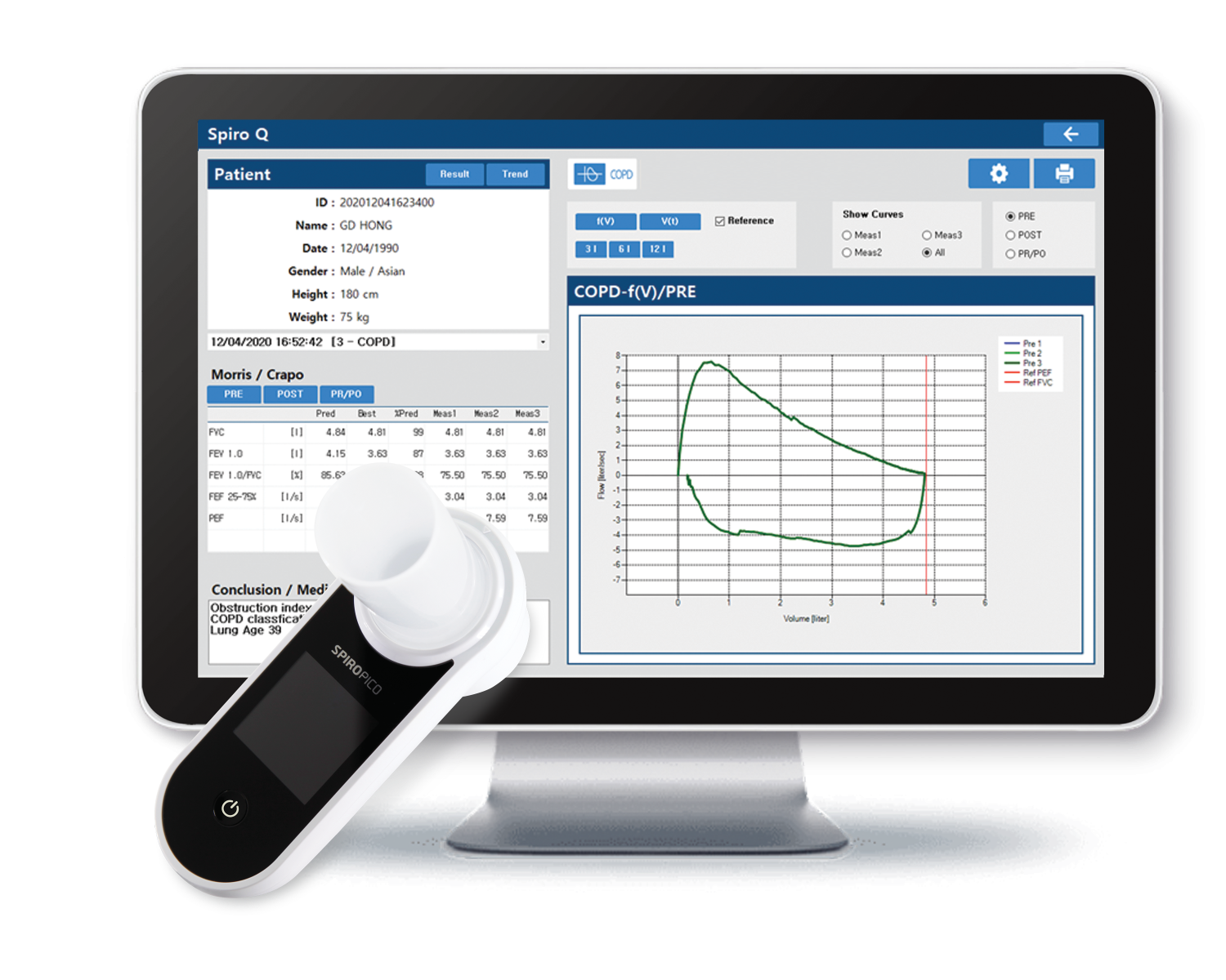 bost vitaflow deluxe portable spirometer  and mouthpiece