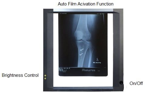 x-ray viewer  (1bay) slimline led